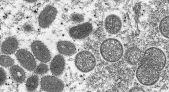 Il vaiolo delle scimmie arriva in Italia, allo Spallanzani il primo caso
