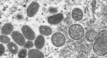 Vaiolo delle scimmie: aumentano i casi nel mondo