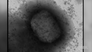 Vaiolo delle scimmie, il virus in liquido seminale